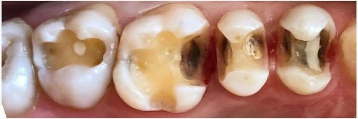 Bangla Dental Care, Sylhet