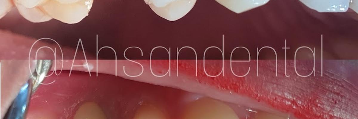 Dr Ahsan Dental Surgery & The Lab Aid Diagnosis Center