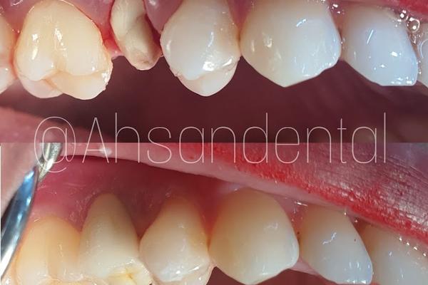 Dr Ahsan Dental Surgery & The Lab Aid Diagnosis Center
