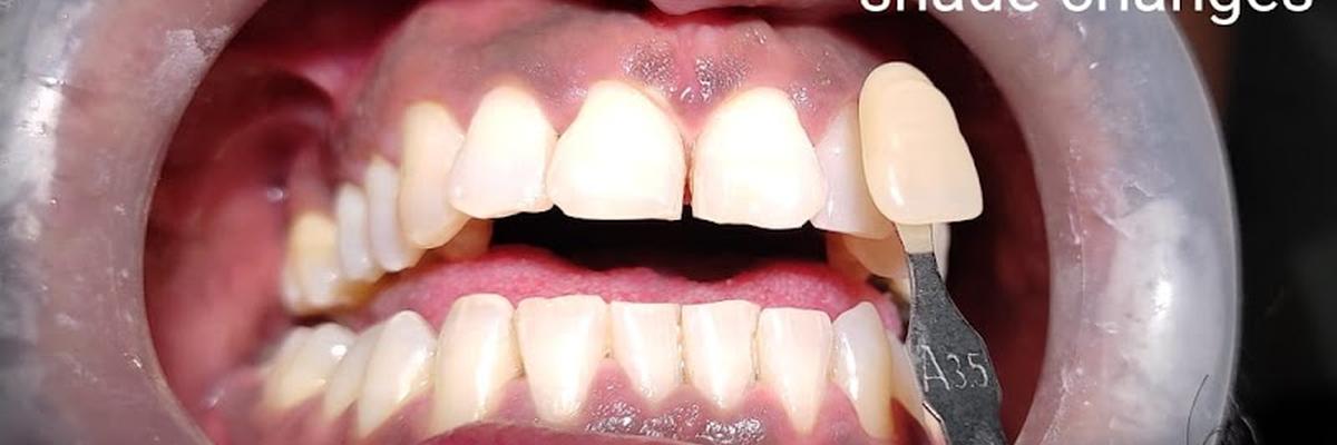 Dr. Imran's Dental Care