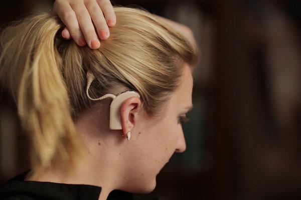 Middle Ear Micro Surgery, Ossiculoplasty, Stapedotomy, Cochlear Implant