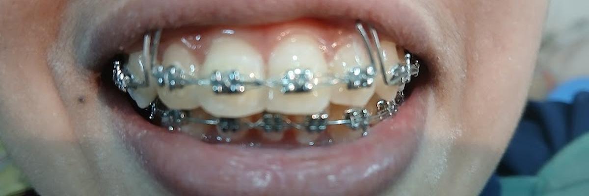 MT Dental Clinic, Mirpur 10