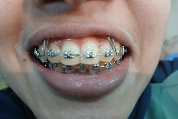 MT Dental Clinic, Mirpur 10
